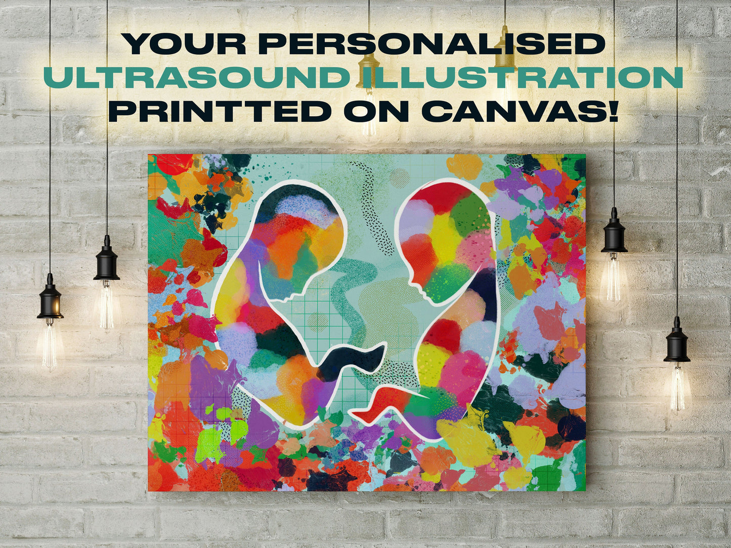 Ultrasound Artwork Sonogram Illustration | Canvas Art Gift for Mom | Bespoke