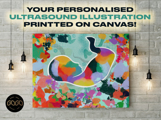 Ultrasound Artwork Sonogram Illustration | Canvas Art Gift for Mom | Bespoke